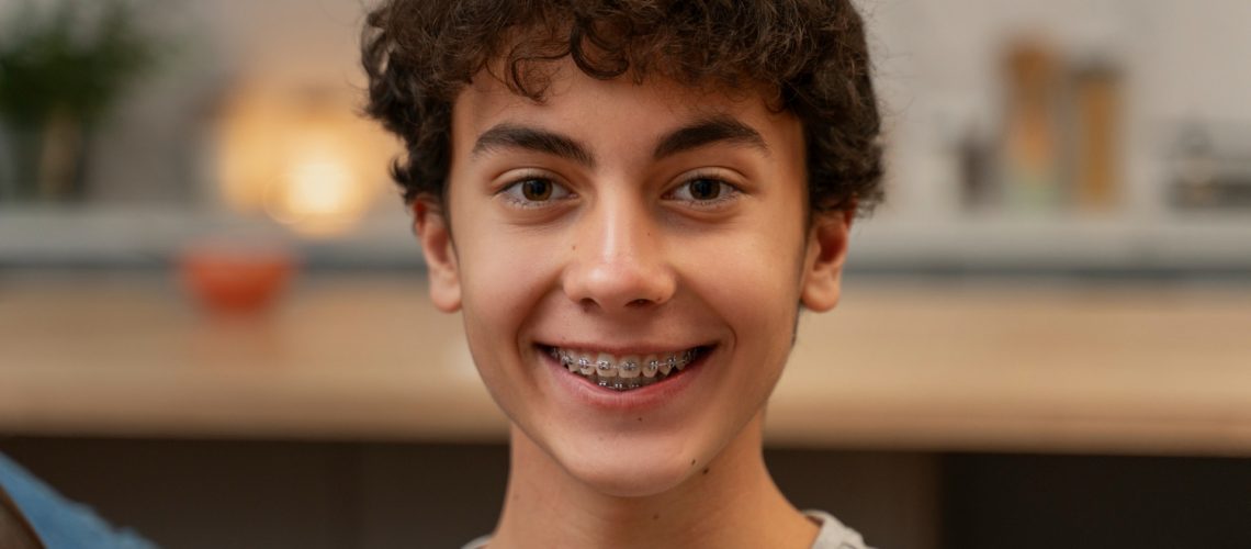 Damon Braces Cost in Dubai