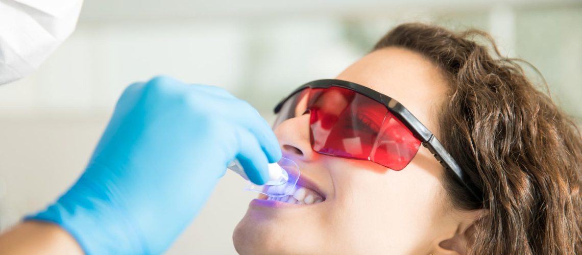 Dental Activators Cost in Dubai
