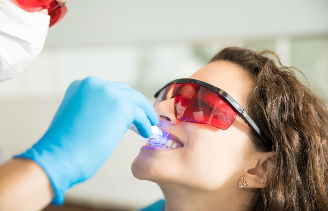 Dental Activators Cost in Dubai