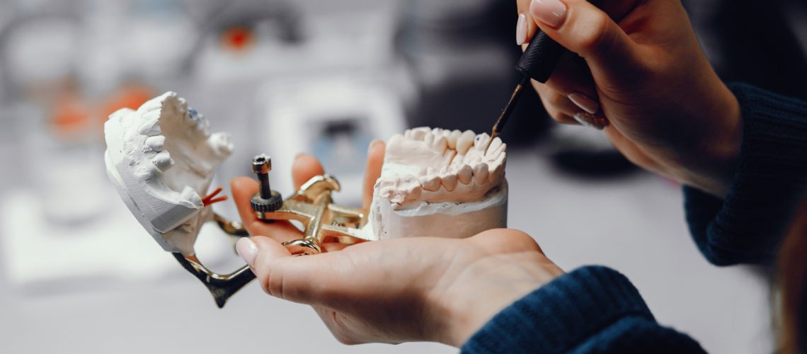 How Much Does It Cost To Get a Full Mouth Dental Implants in Dubai