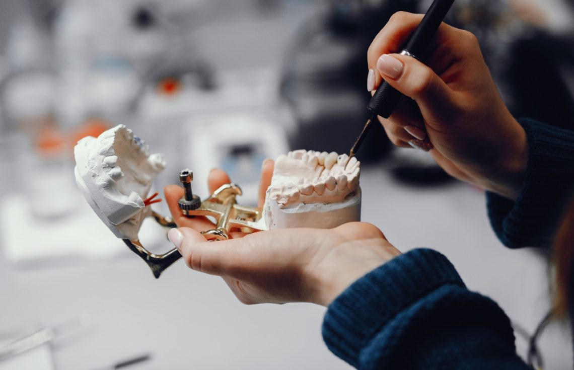 How Much Does It Cost To Get a Full Mouth Dental Implants in Dubai