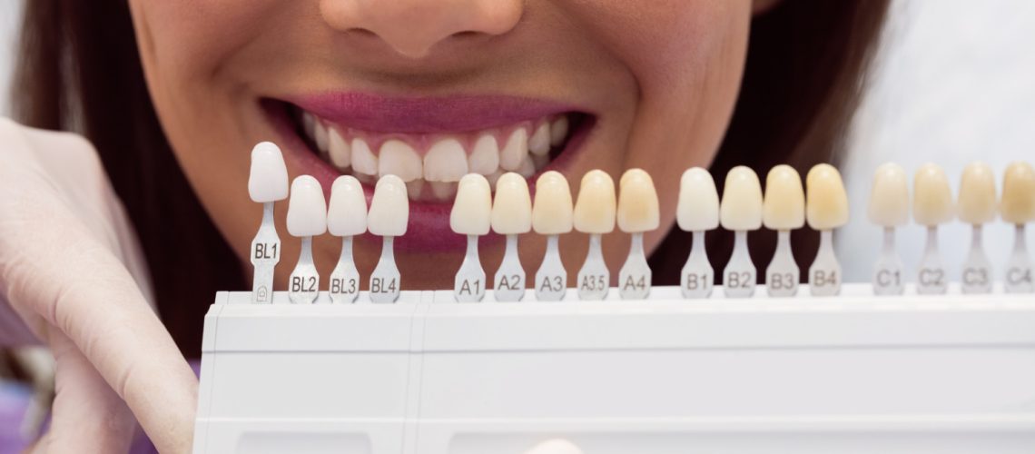 Dental Veneers What You Need To Know