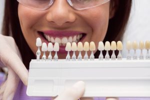 Dental Veneers What You Need To Know