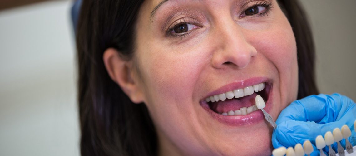 Zirconia Dental Crowns Advantages And Disadvantages