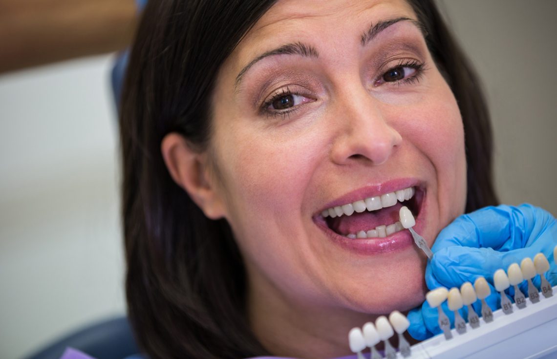 Zirconia Dental Crowns Advantages And Disadvantages