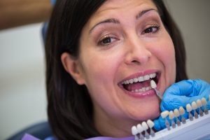 Zirconia Dental Crowns Advantages And Disadvantages