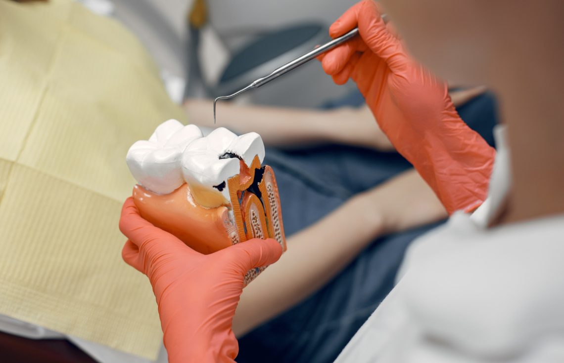 Root Canal Treatment In Dubai By An Italian Dentist Pain Relief And Tooth Preservation