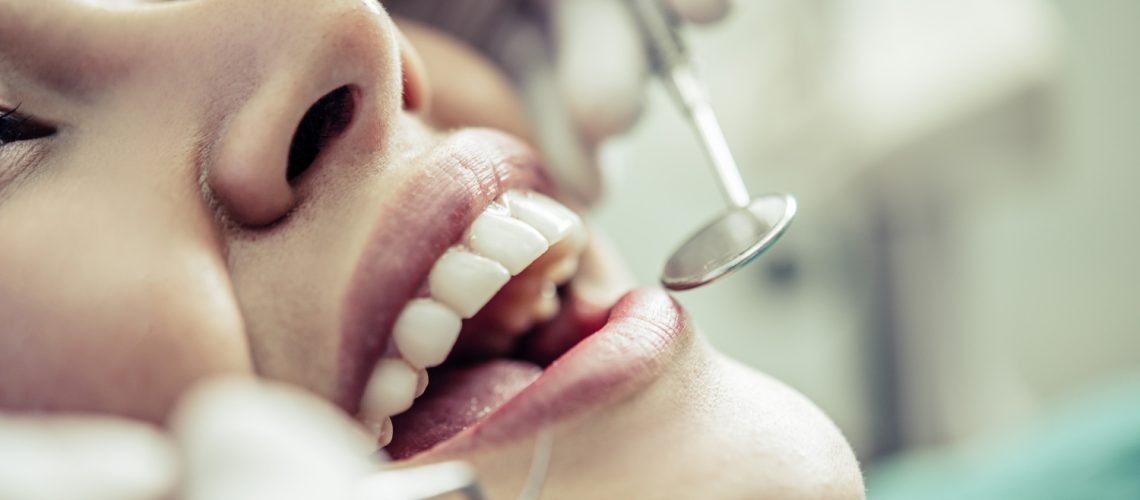 Teeth Whitening For The Holidays By An Italian Dentist In Dubai