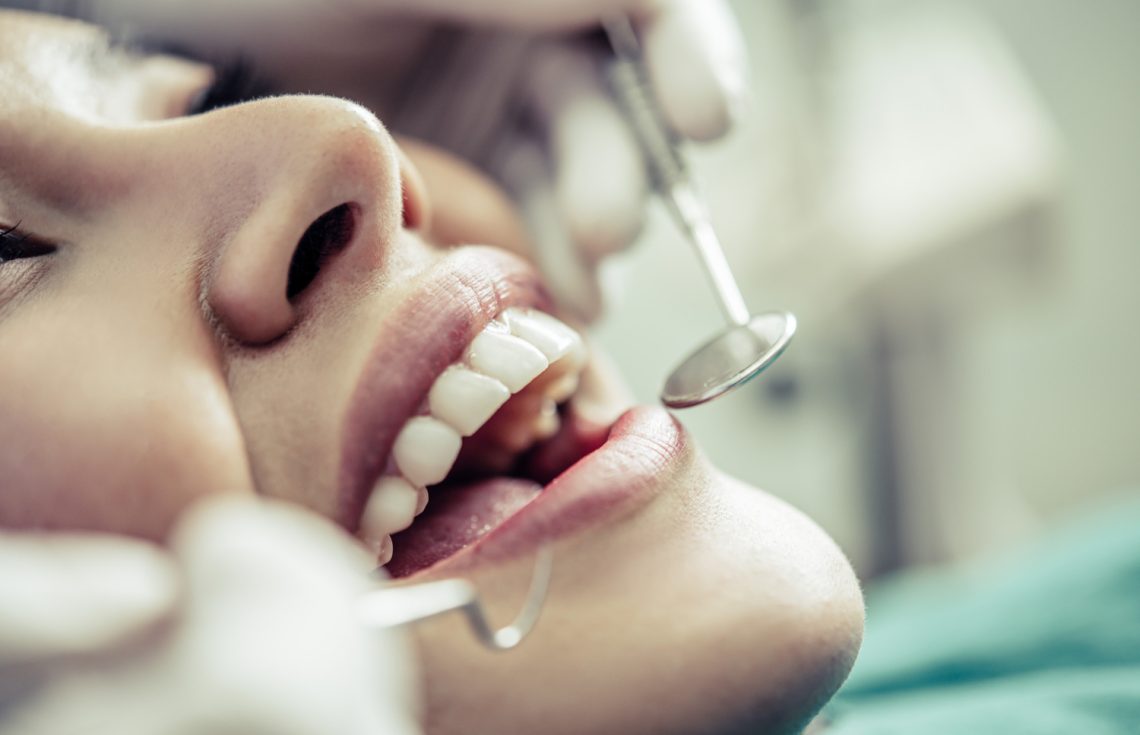 Teeth Whitening For The Holidays By An Italian Dentist In Dubai