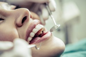 Teeth Whitening For The Holidays By An Italian Dentist In Dubai