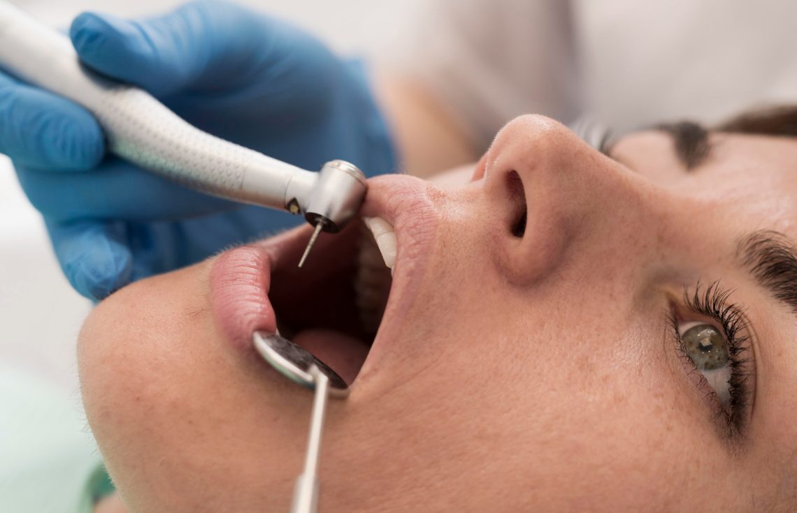 12 Common Sign You Might Need A Dental Filling