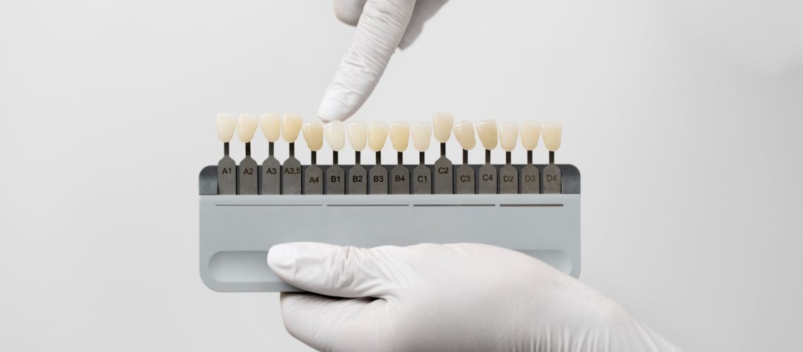 PFM VS Zirconia Which Material Is Better