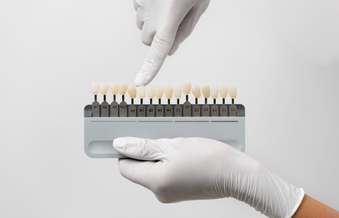 PFM VS Zirconia Which Material Is Better