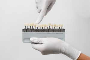 PFM VS Zirconia Which Material Is Better