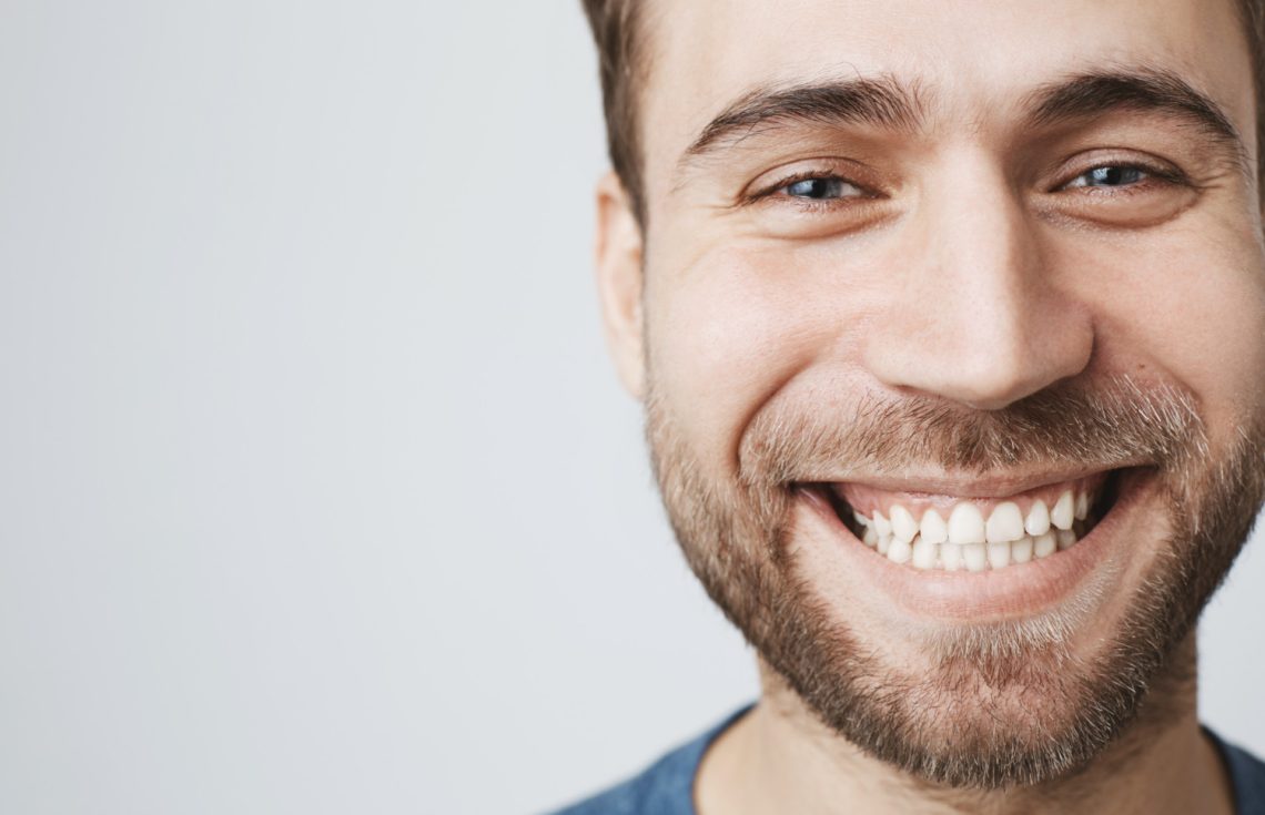 Popular Gummy Smile Correction Options