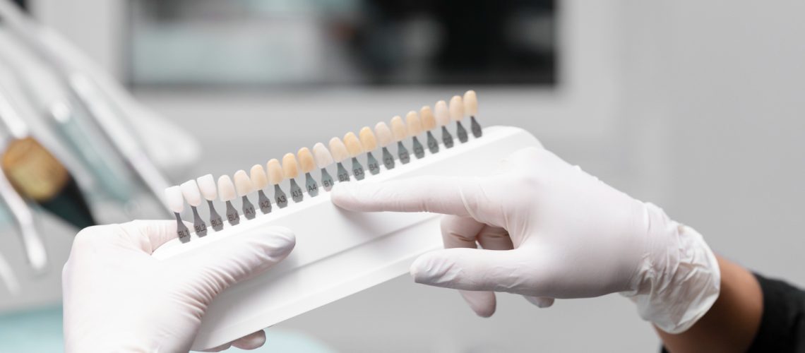 What Are Emax Veneers And Why Are They Preferred In Dental Aesthetics