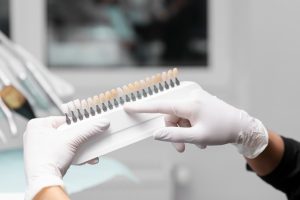 What Are Emax Veneers And Why Are They Preferred In Dental Aesthetics