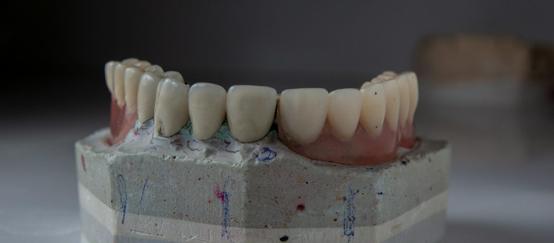 Enhance Your Smile With E.max Veneers The Ultimate Guide