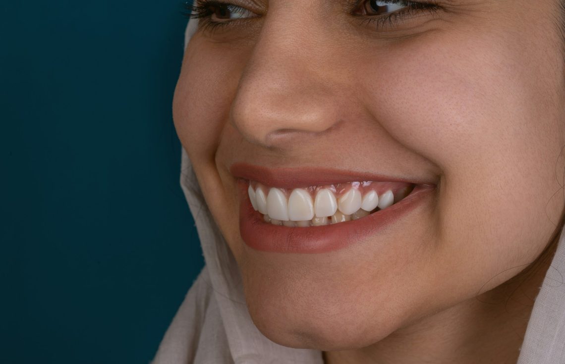 Exploring The Hollywood Smile Procedure In Detailed Steps
