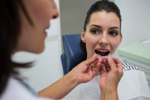 How Invisalign Works A Step-By-Step Guide To The Invisalign Process