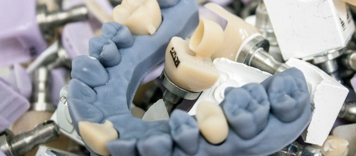 Zirconia Crown In Dubai Your Ultimate Guide