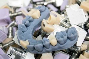 Zirconia Crown In Dubai Your Ultimate Guide
