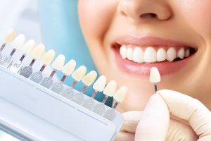 A Complete Guide To Dental Veneers