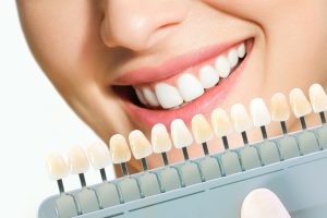 Types of Dental Crowns and Cost A Complete Guide to 2026